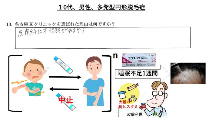 円形脱毛症　病院